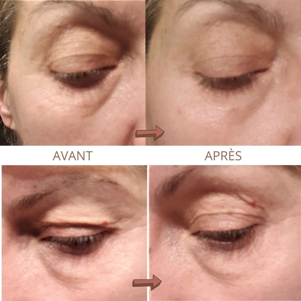 beautical Sérum Liftant Instantané Effet anti-rides immédiat