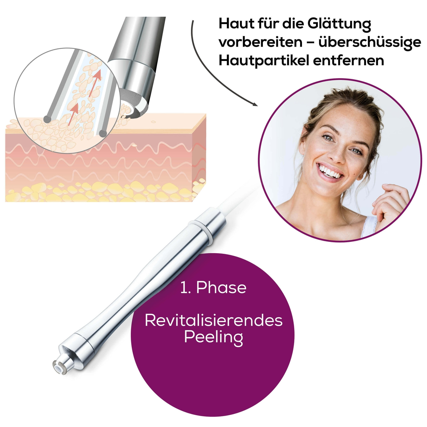 Beurer Mikrodermabrasion FC 100 Pureo Derma Peel-Mikrodermabrasion - Professionelles Peeling für zu Hause
