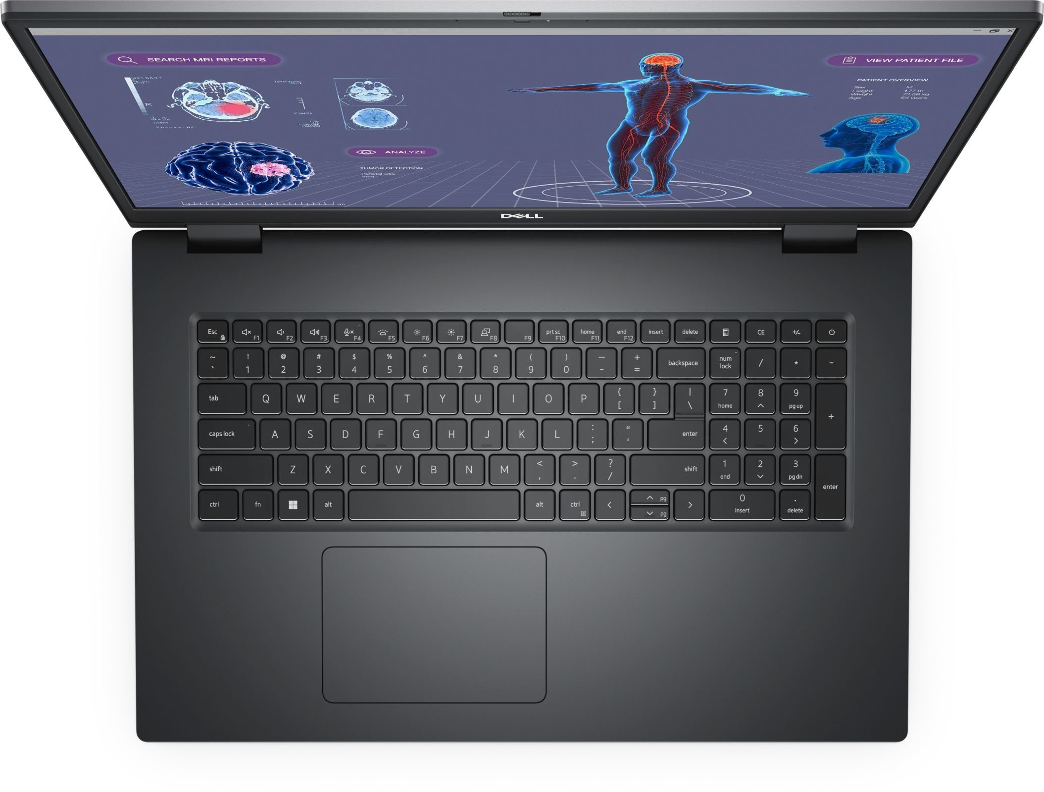Dell Precision 7780 - 43.2 cm (17) - Intel Core i7-13850HX - Grau Notebook (Intel Core i7 13. Gen i7-13850HX, NVIDIA GeForce RTX 3500, 1000 GB SSD)