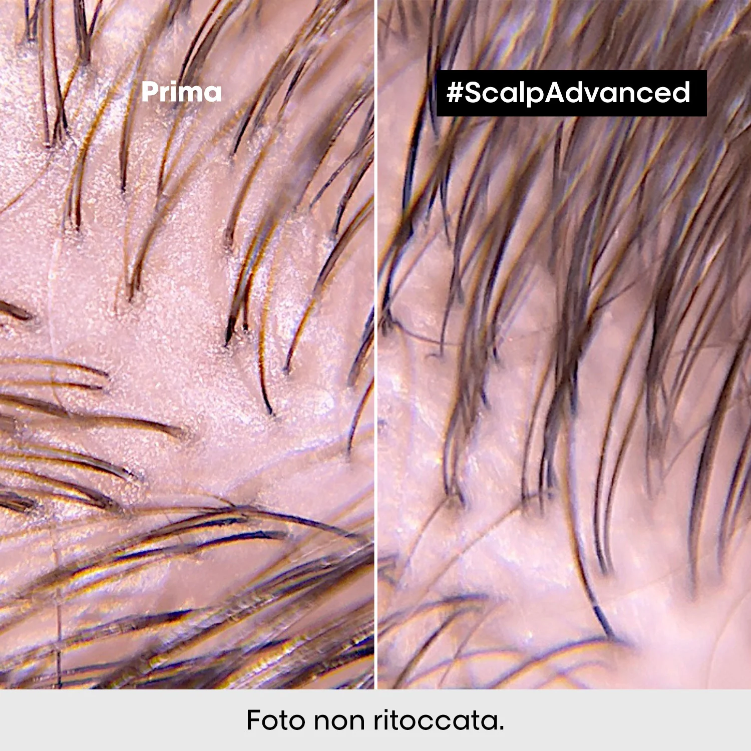 Serie Expertos Nuevo Champú Avanzado Antigrasa para el Cuero Cabelludo - Champú Purificante