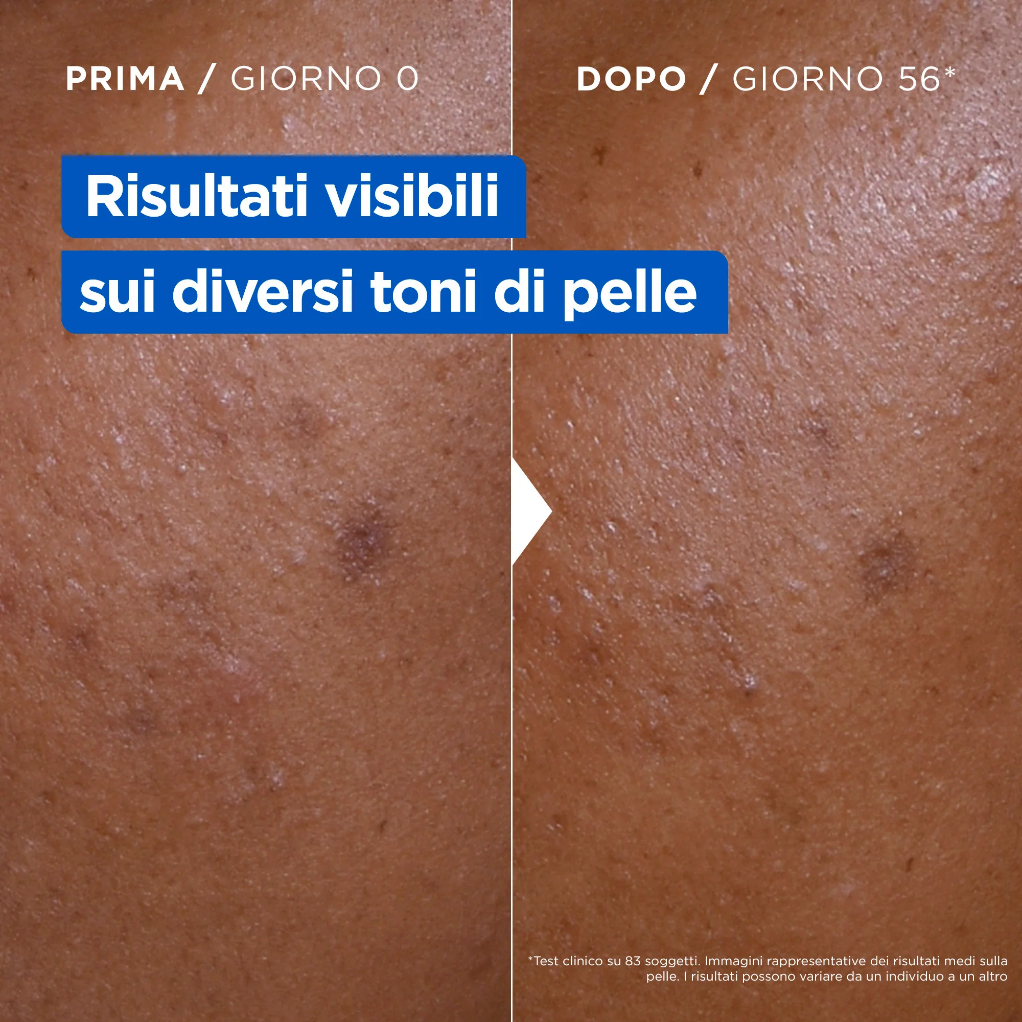 Niacinamid Bright Body - Hidratantna krema za tijelo, Iluminirajuća krema za tijelo