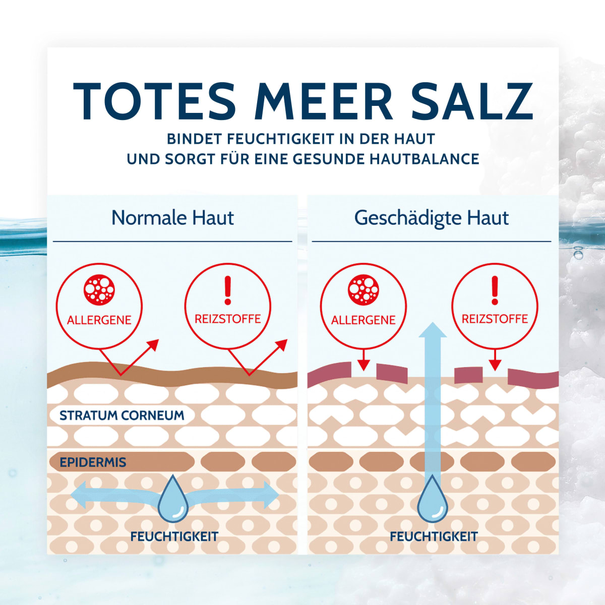 Pflegecreme Neurodermitis Salbe Totes Meer Therapie, 75 ml