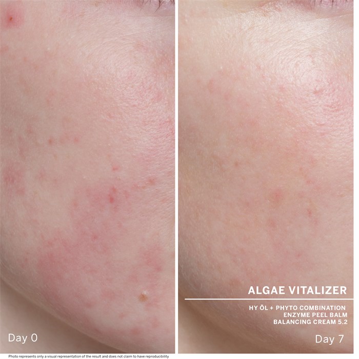 Algae Vitalizerr 7 Ampoules