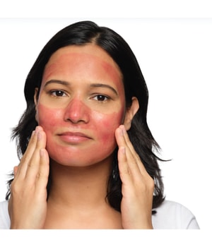 The Ordinary Direct Acids AHA 30% + BHA 2% Peeling Solution Gesichtspeeling-30 ml