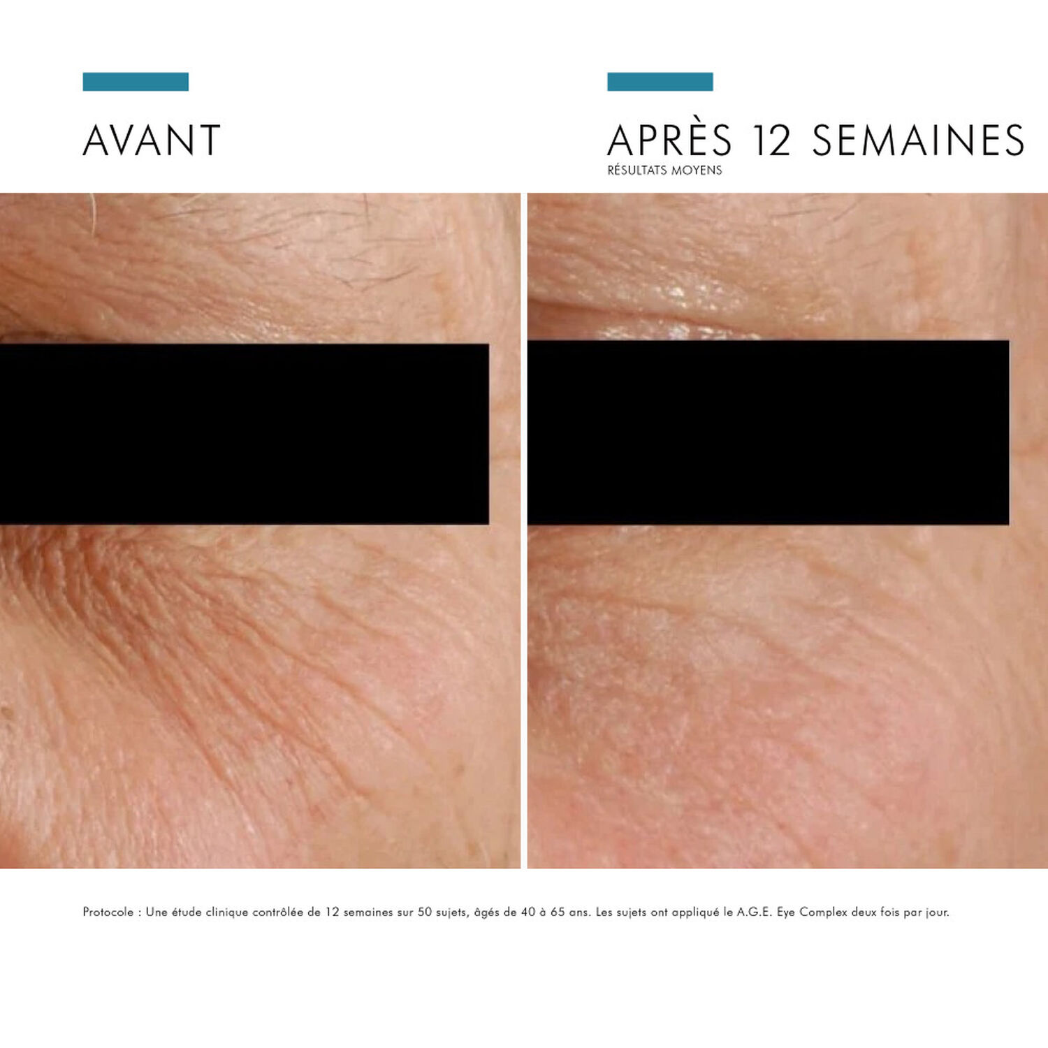 Skinceuticals A.G.E Eye Complex Soin Contour Des Yeux Anti-Rides, Anti-Poches, Anti-Cernes 15 ml