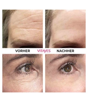 VITAYES Instant Ageback Gesichtscreme 7 ml