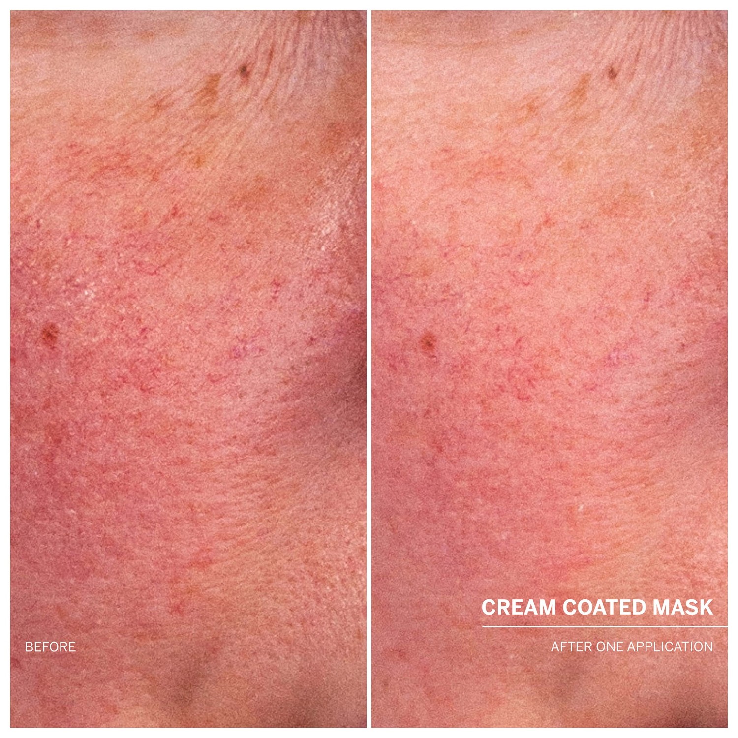 Cream Coated Mask