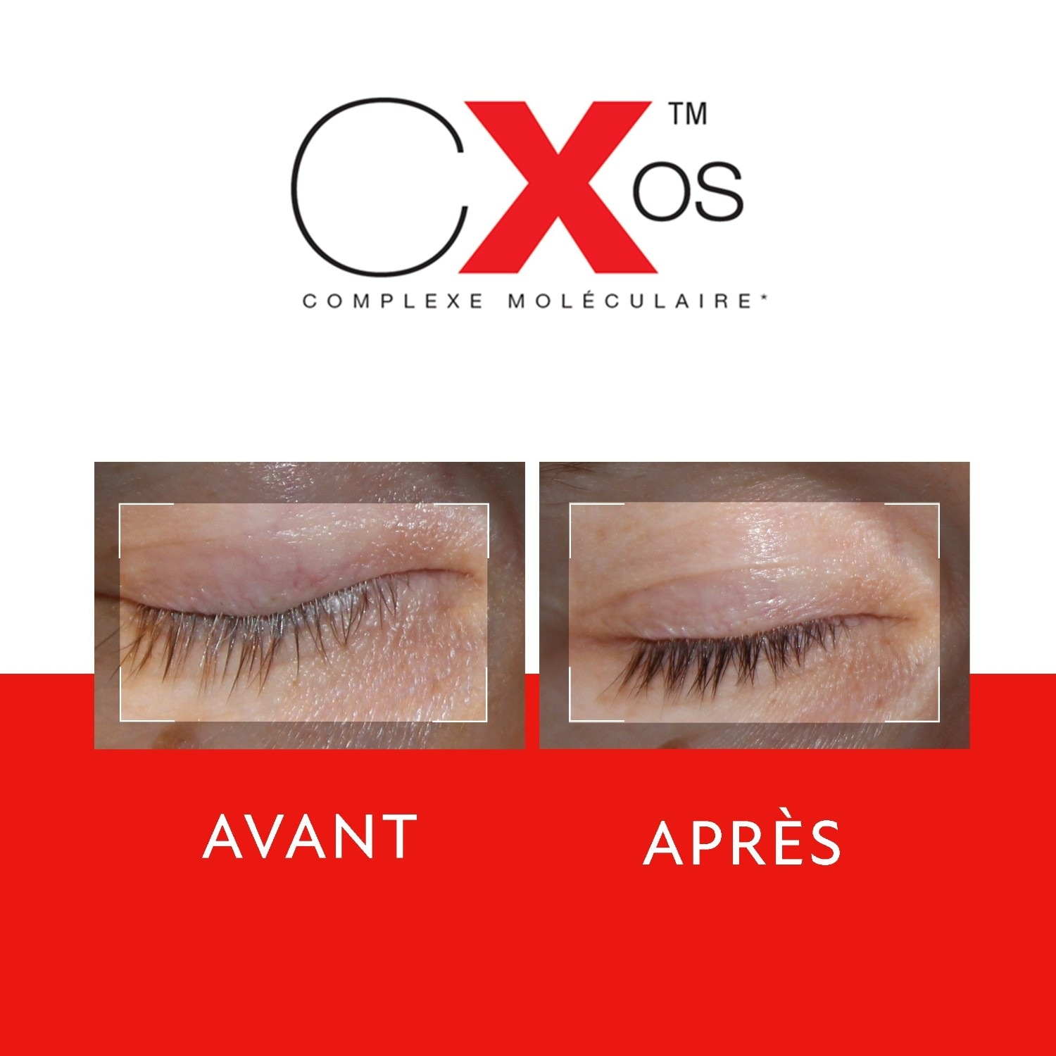 Oscience Eye Care Globalna korekcija