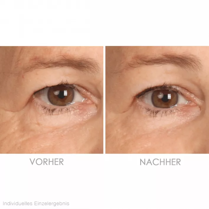 VINOLIFT Augencreme