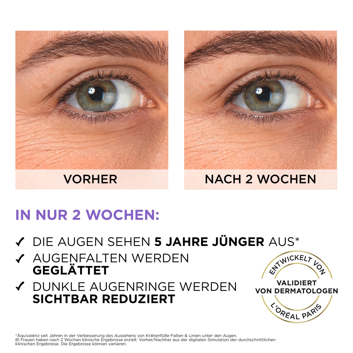 Augenserum Revitalift Filler Hyaluron + Koffein, 20 ml