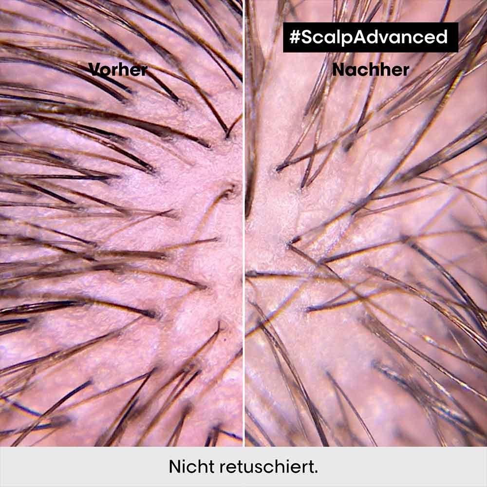 L&'Oréal Professionnel Serie Expert Scalp Advanced Anti-Discomfort Dermo-Regulator Shampoo