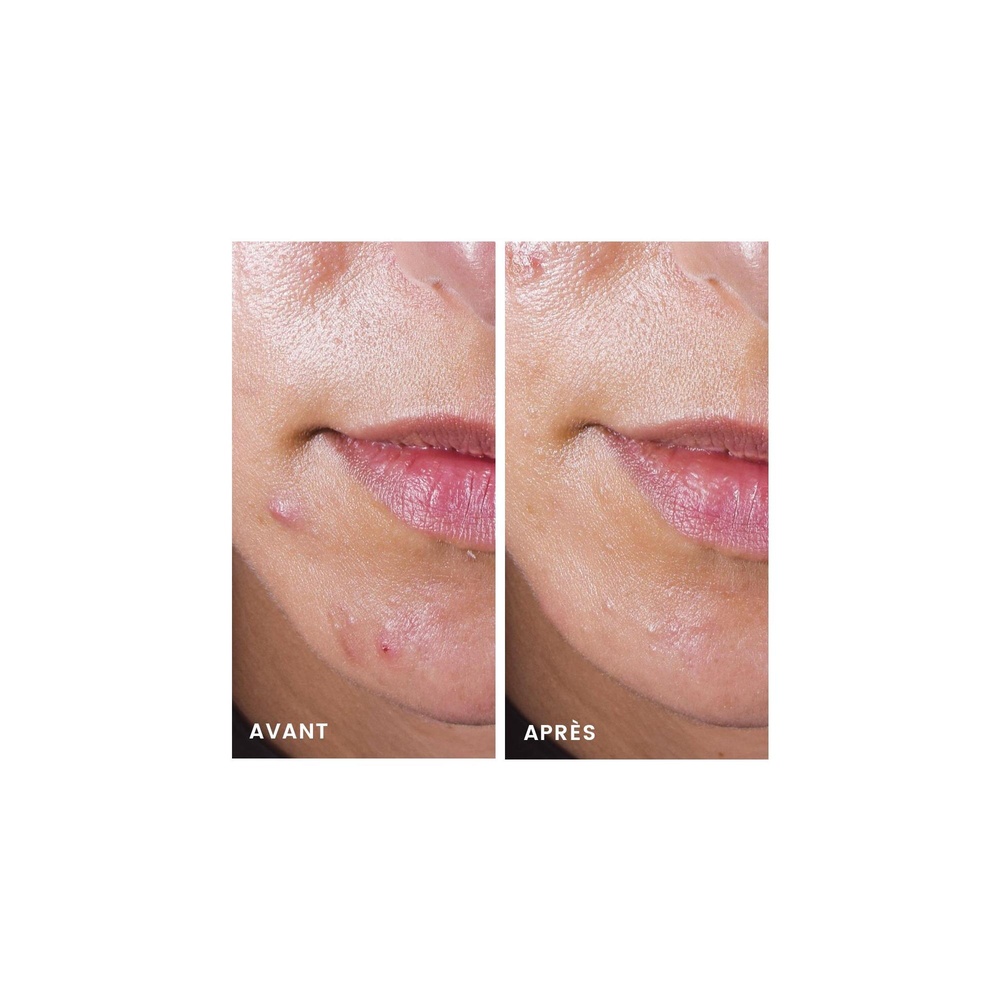 Avène Cleanance Comedomed 30 ml Concentré anti-imperfection