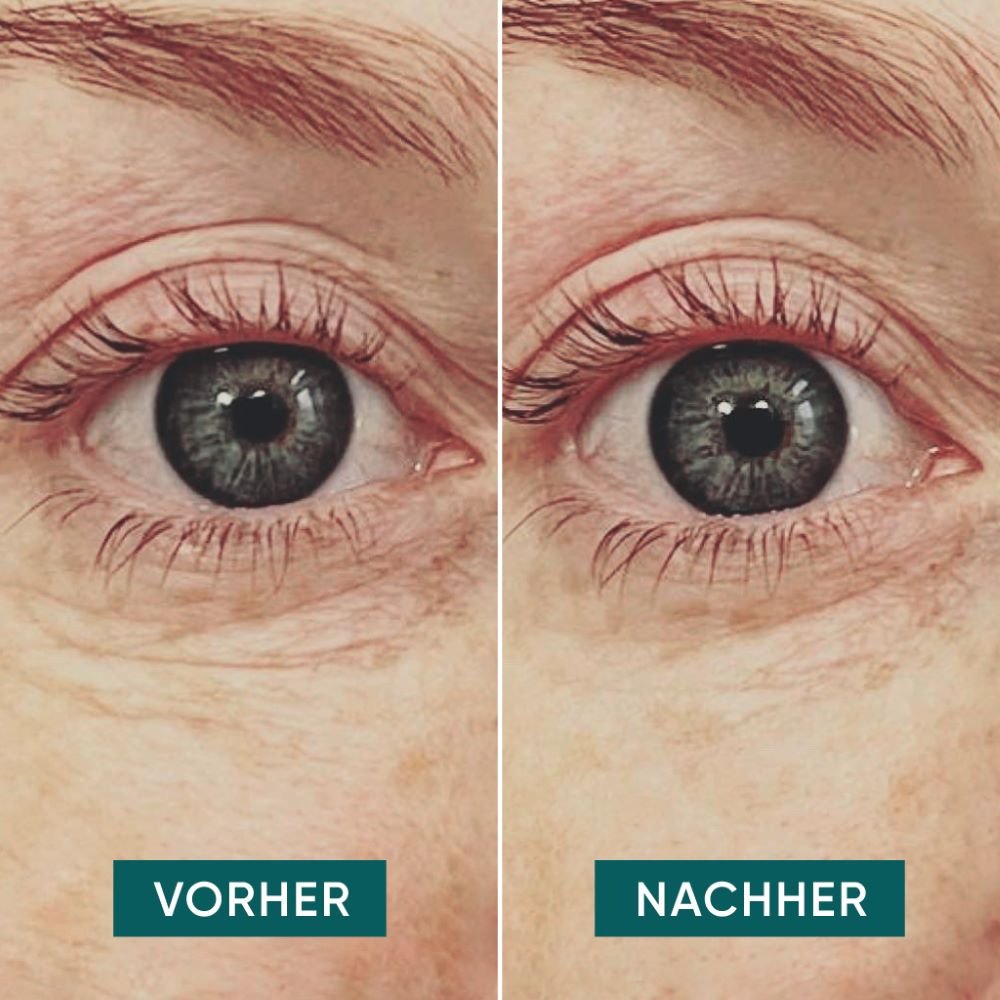 Apricot Beauty Pads Augen Pads mit Hyaluron