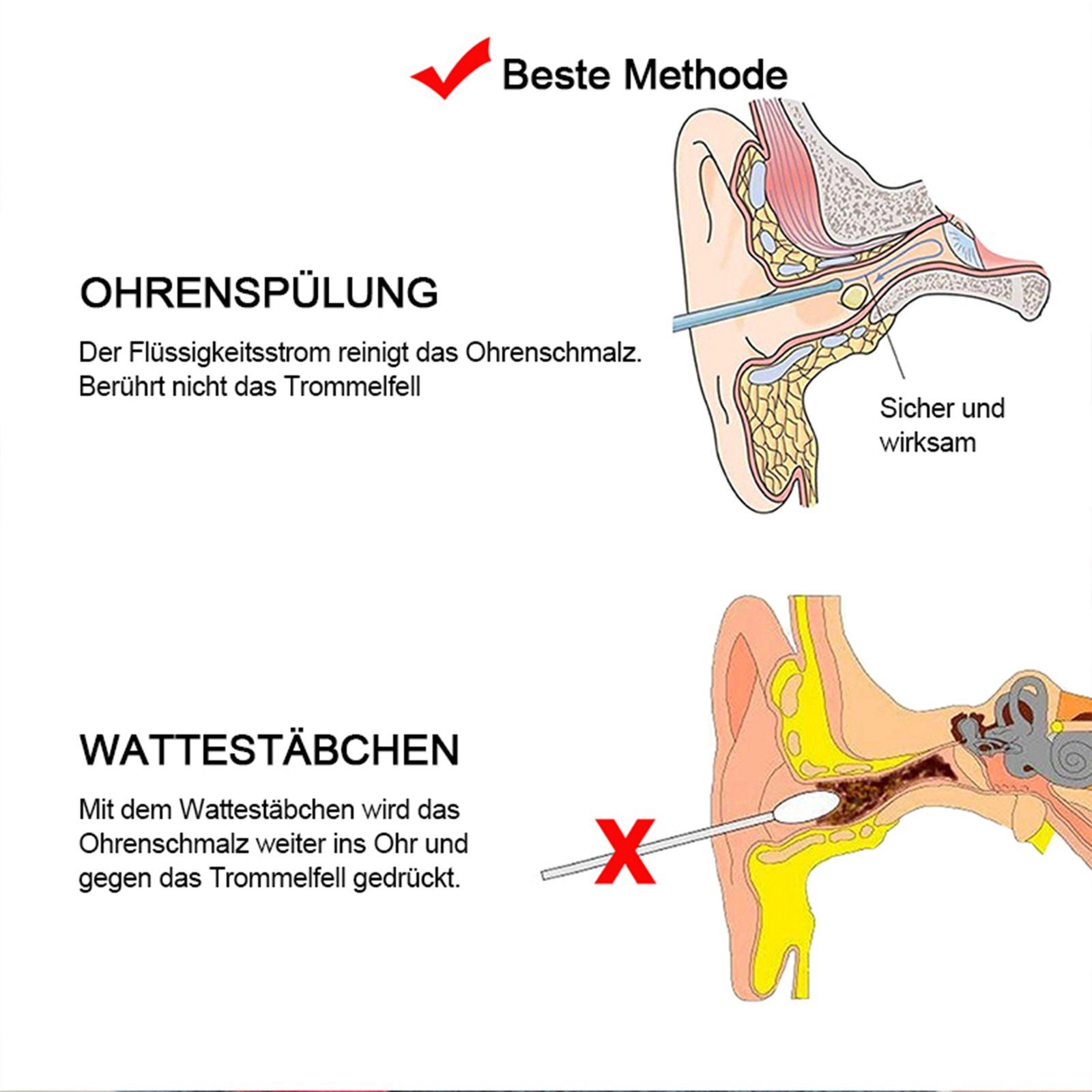 TWSOUL Ohrenreiniger Safe Ear Washer, Ohrenschmalz-Entfernungsset, Menge der koordinierten Elemente, Hausgebrauch Erwachsene Kinder Baby Ohrreiniger