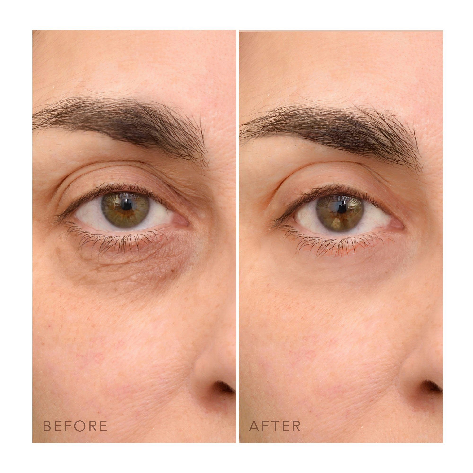 FOREO Augencreme IRIS™ C-CONCENTRATED EYE CREAM 15 ml