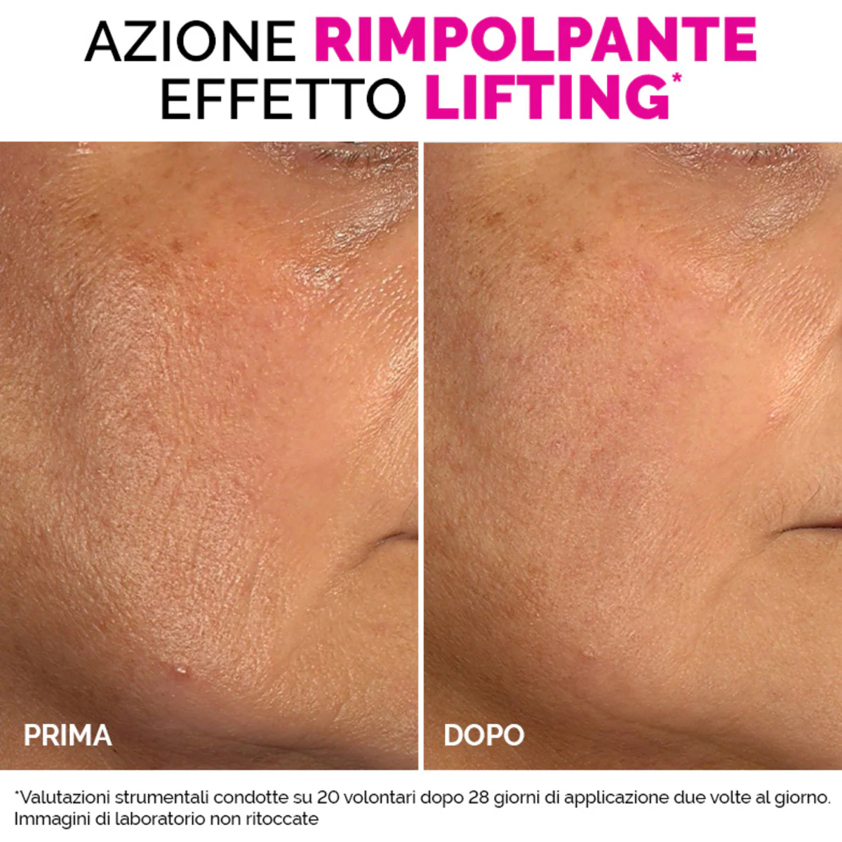 Feltöltő arckrémek - Feltöltő mattító arckrém - Hidratáló nappali krém, Pattanás elleni nappali krém, Ránctalanító nappali krém, 24 órás arc lifting kezelés