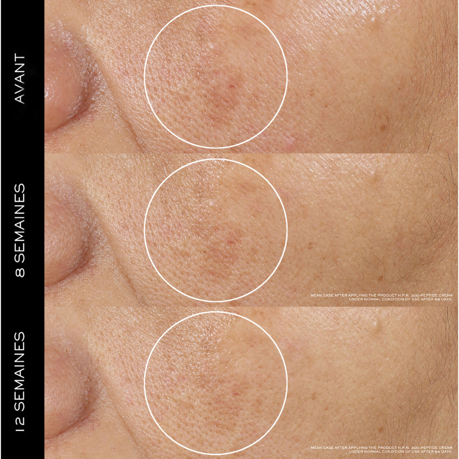 lancôme Rénergie Crème H.P.N 300-Peptide Anti-Age