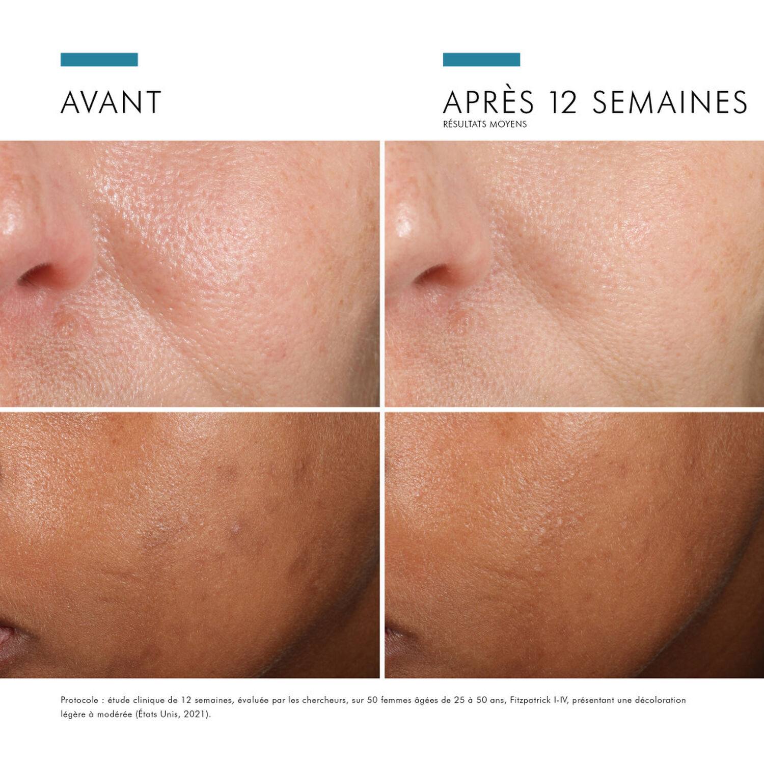 Skinceuticals Phloretin CF Serum Antioxydant Haute Performance 30 ml