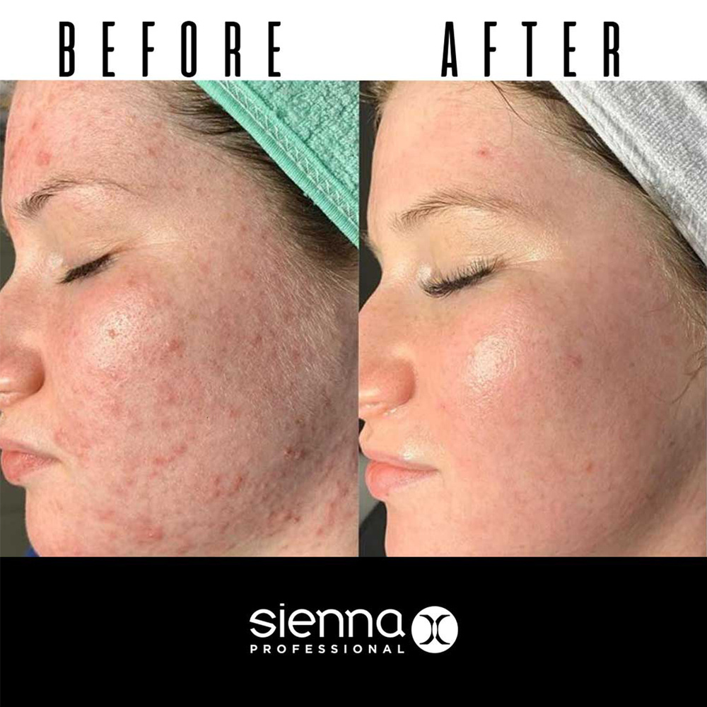 sienna x LE MASQUE D’ARGILE CARE