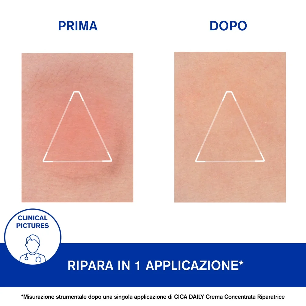 Crema reparadora concentrada CICA DAILY - Tratamiento reparador, tratamiento facial hidratante de 24 horas