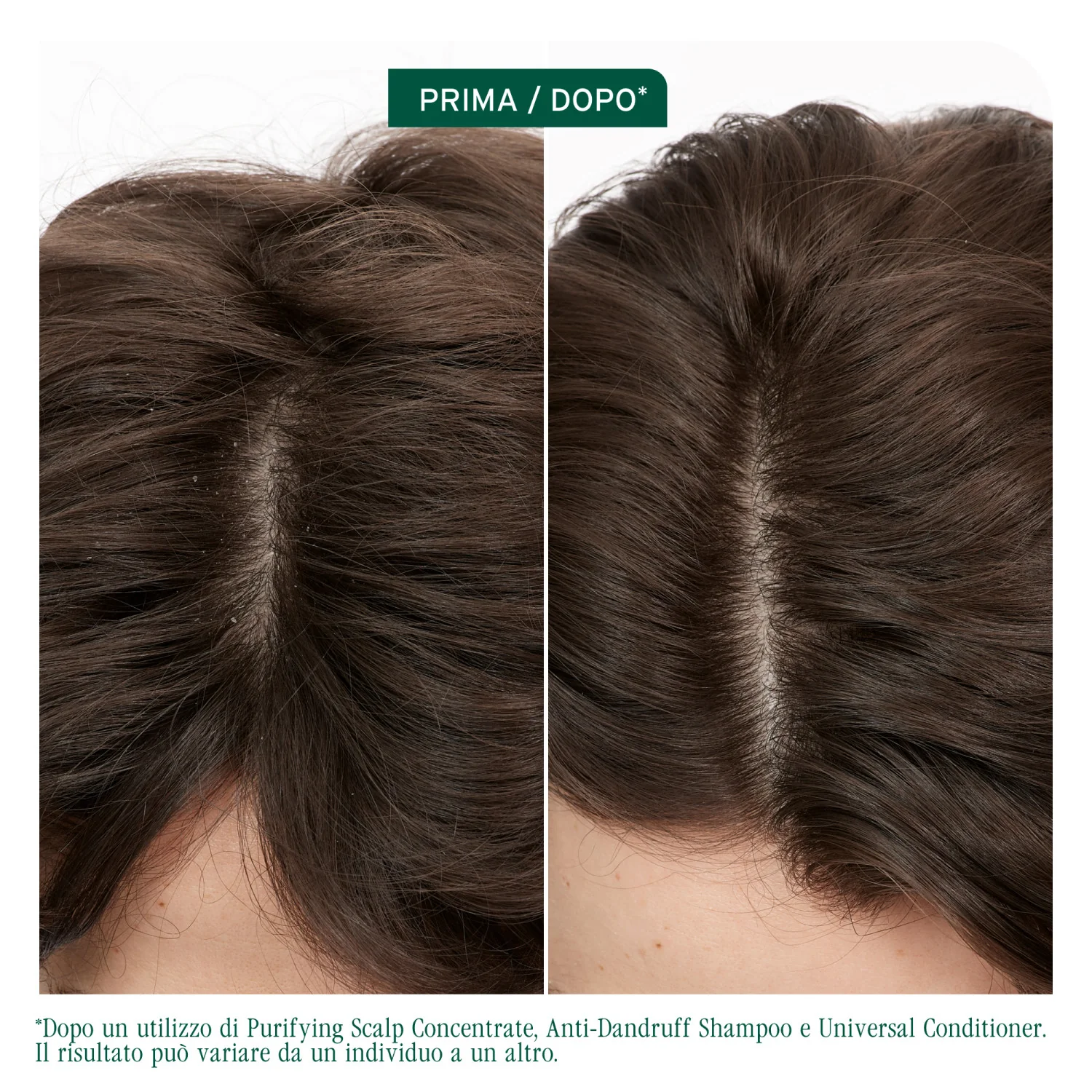 Condicionador Universal Scalp Sync - Condicionador Hidratante para Cabelos