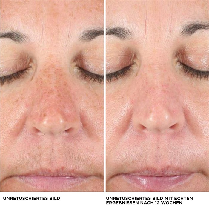 Bye Bye Dark Spots Concealer
