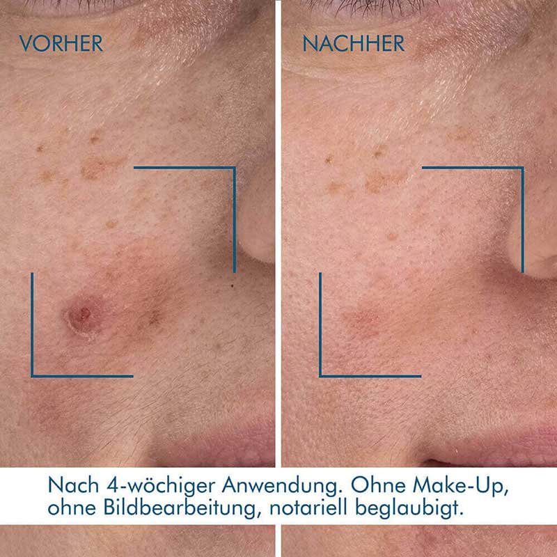 Biotherm Blue Therapy Blue Retinol Resurface + Repair Night Serum