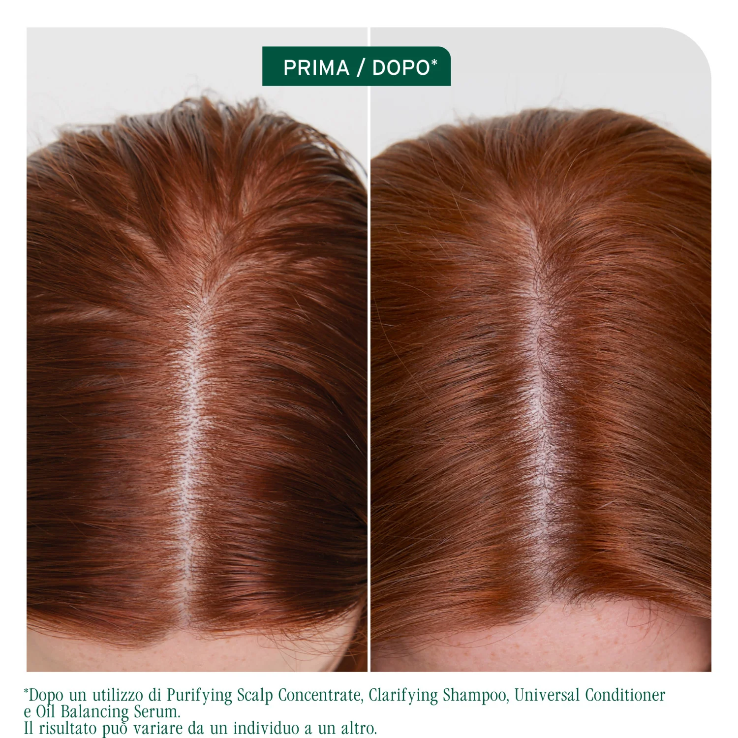 Scalp Sync Olajkiegyensúlyozó Szérum - Hajolaj