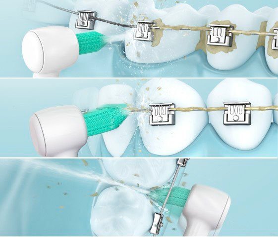 Panasonic Munddusche EW1513, Aufsätze: 2 St., kabellose Munddusche mit orthodontischer Düse