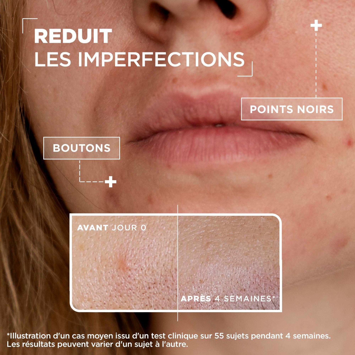 Mixa koncentrirani serum proti nepravilnostim