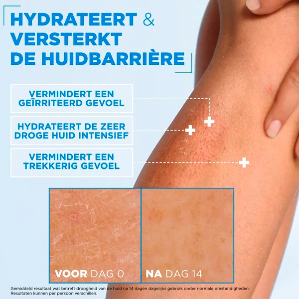 Hydratačný krém Mixa Ceramide Protect 400ml