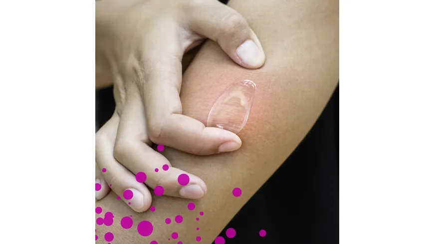 Emcur Zeckenstich-Gel 20 ml