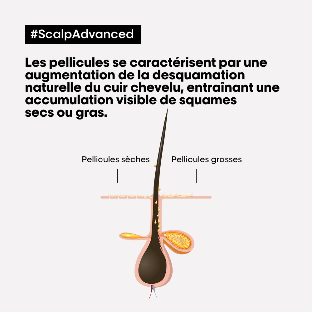 L'Oréal Professionnel Serie Expert Scalp Advanced - Shampoingdermo-clarifiant anti-pelliculaire Shampoing
