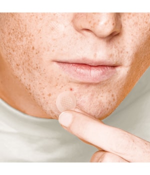 Acnemy Zitless Pimple Patches-5 Stk