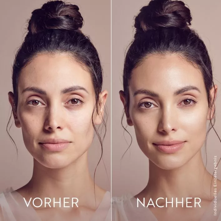 MAGIC CARE Overnight Treatment AHA & BHA Fruchtsäurepeeling