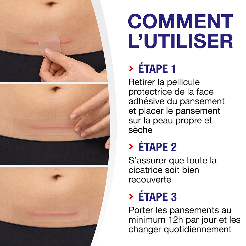 elastoplast Elastoplast Réducteur de Cicatrices XL - Boîte de 21 pansements Pansements réducteurs de cicatrices