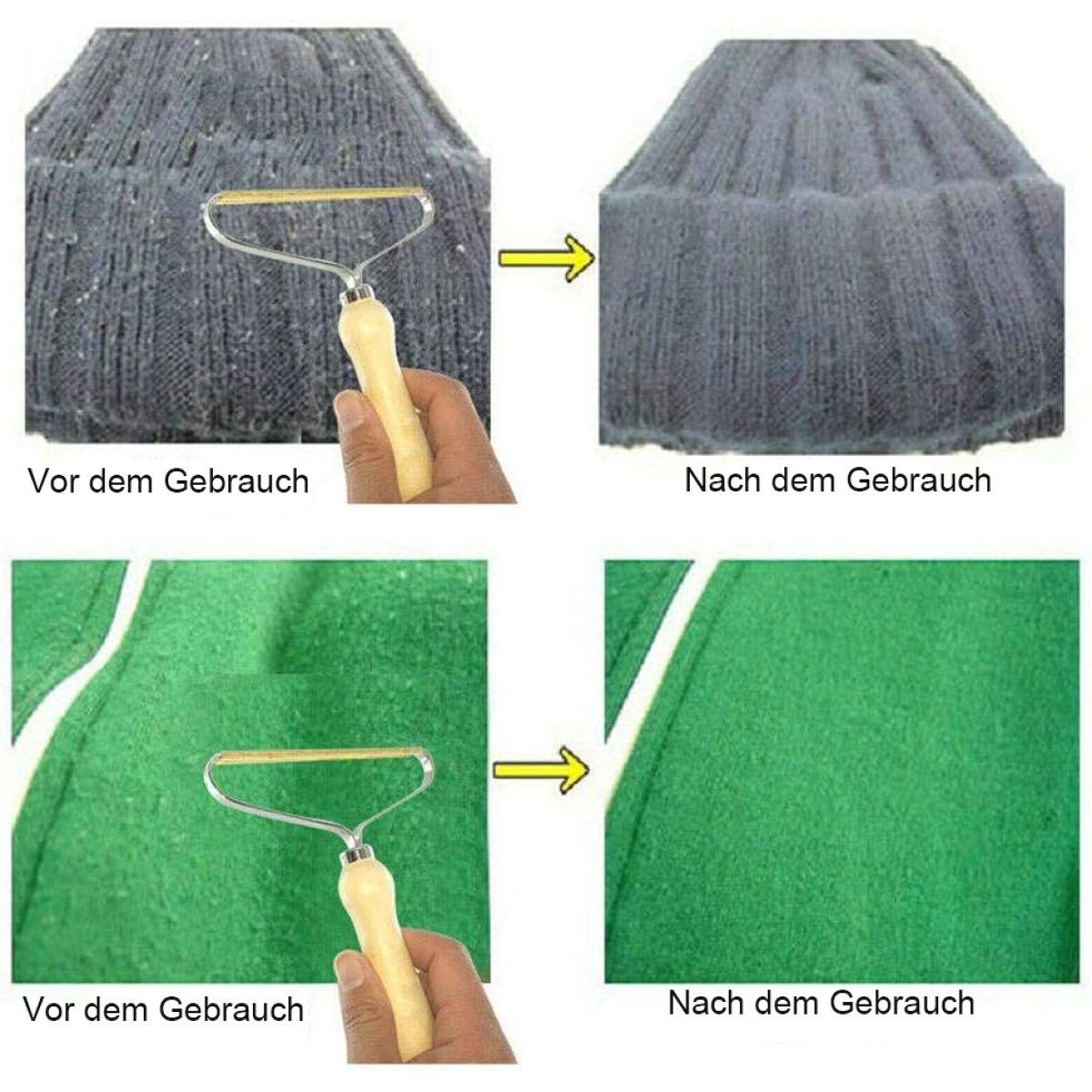ZmdecQna Fusselrasierer Fusselentferner,Tragbarer,um Flusen von Kleidung,Sofas zu Entfernen
