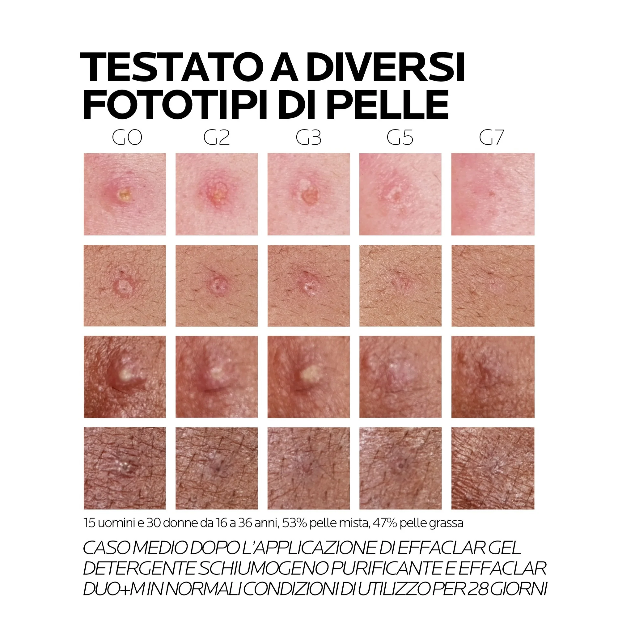 Effaclar Effaclar Duo+M Trattamento Viso Anti-imperfezioni - Gel viso antimperfezioni