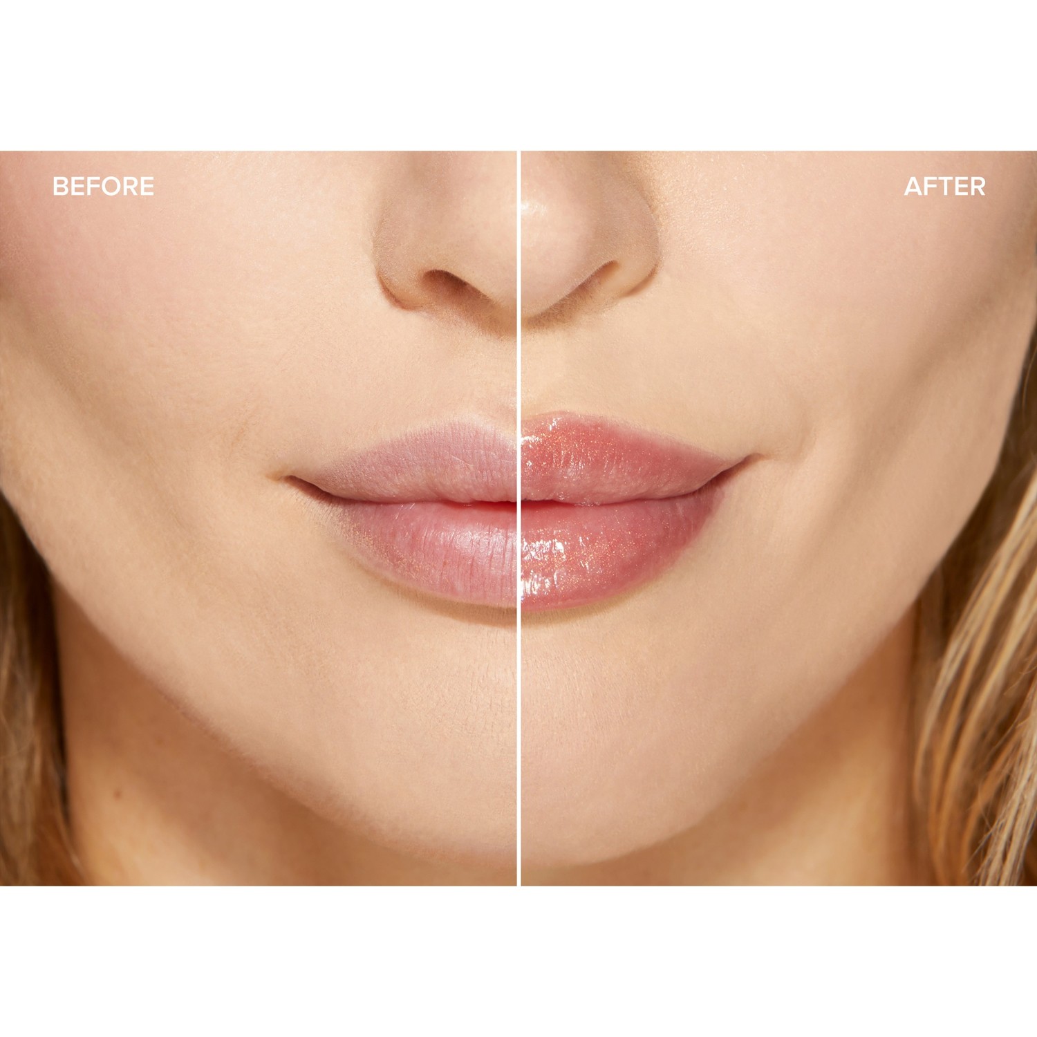 Lip Injection Maximum Plump