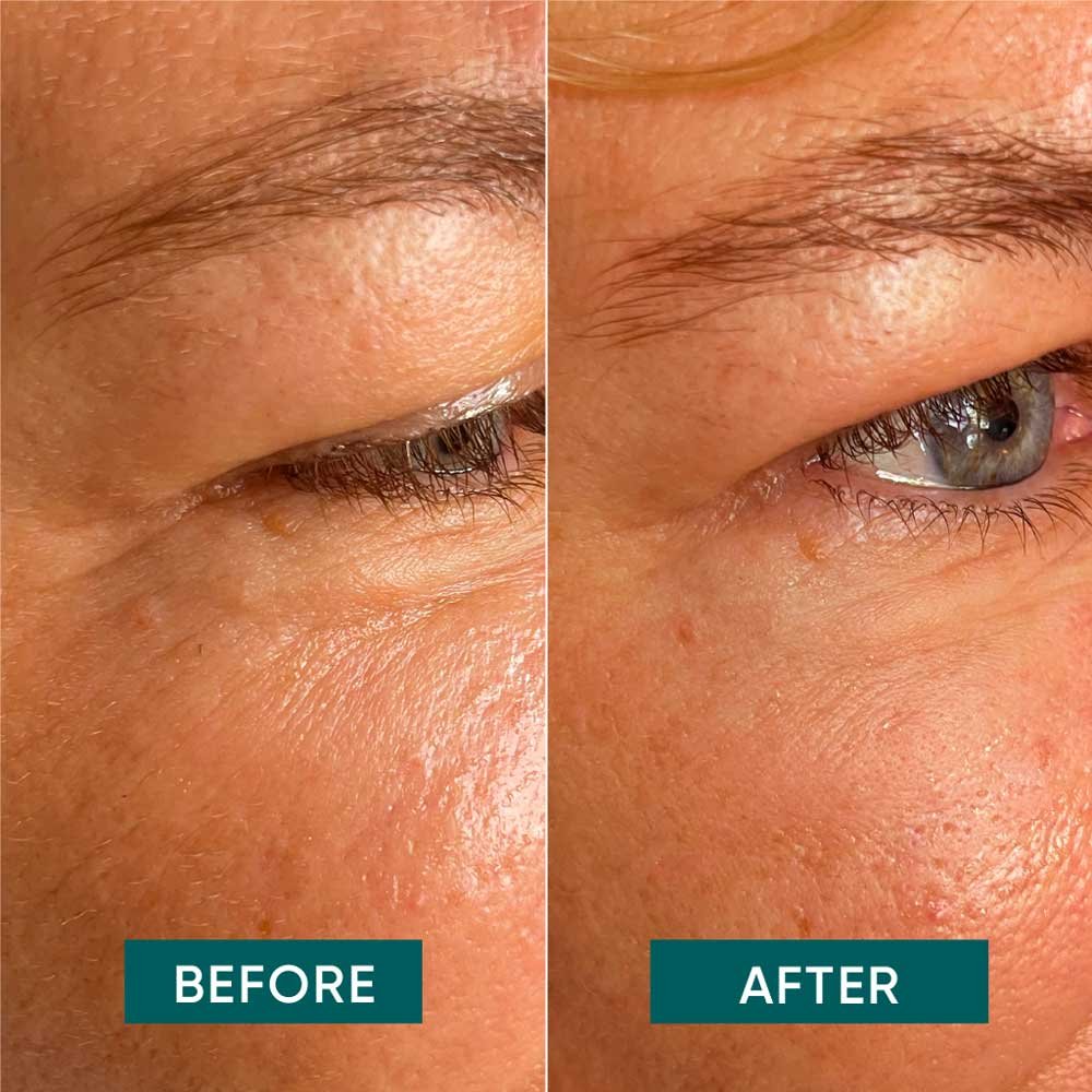 Apricot Beauty Pads Eye & Temple Pads