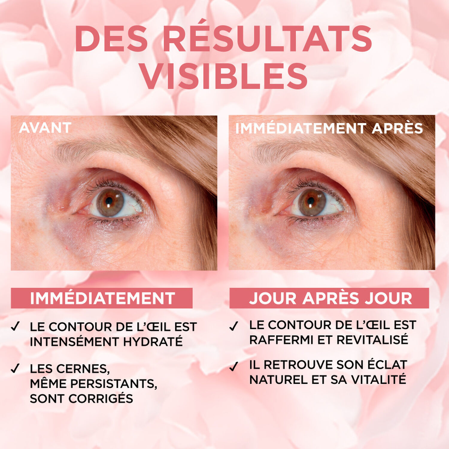 L'Oréal Paris Age Perfect Golden Age Soin Contour des Yeux Anti-Âge