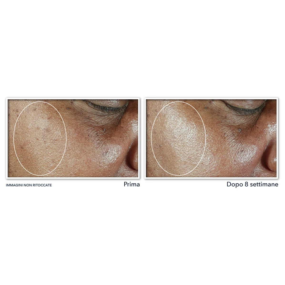 Crema hidratante facial Multi Correxion para un tono uniforme y efecto lifting con SPF30 - Crema de día reafirmante, crema de día hidratante, crema de día antiimperfecciones, crema de día iluminadora.