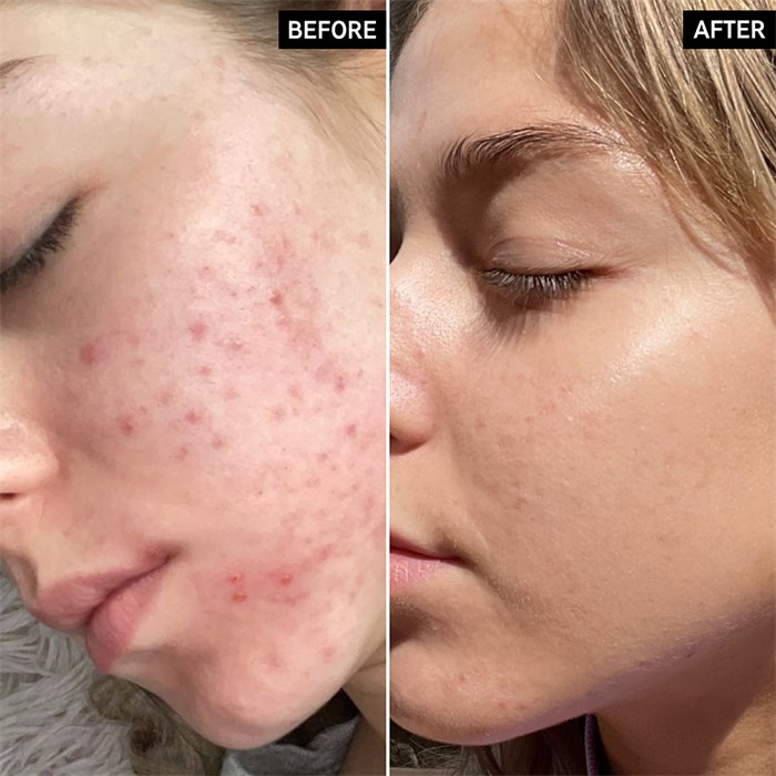 Niacinamide Serum
