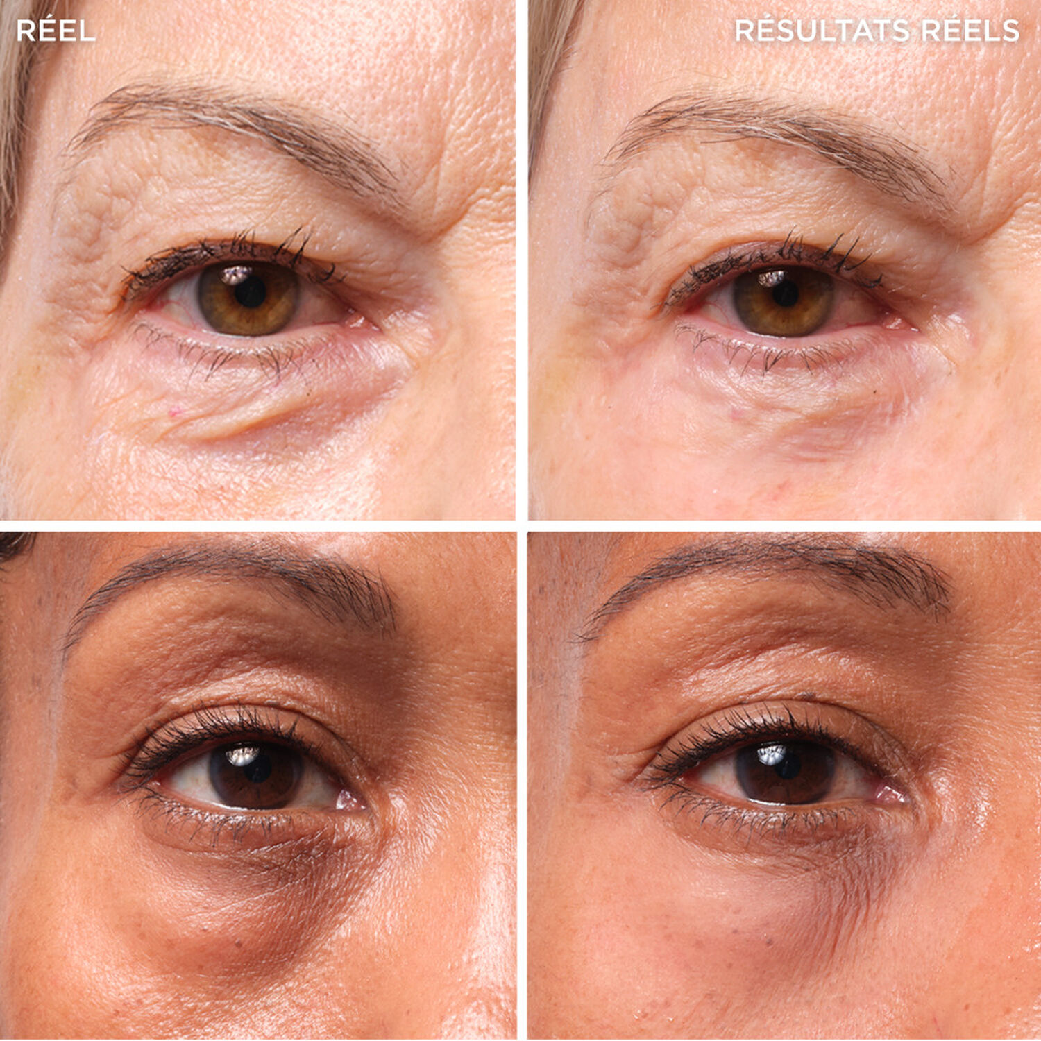 It Cosmetics Bye Bye Under Eye Bags Soin Contour des Yeux