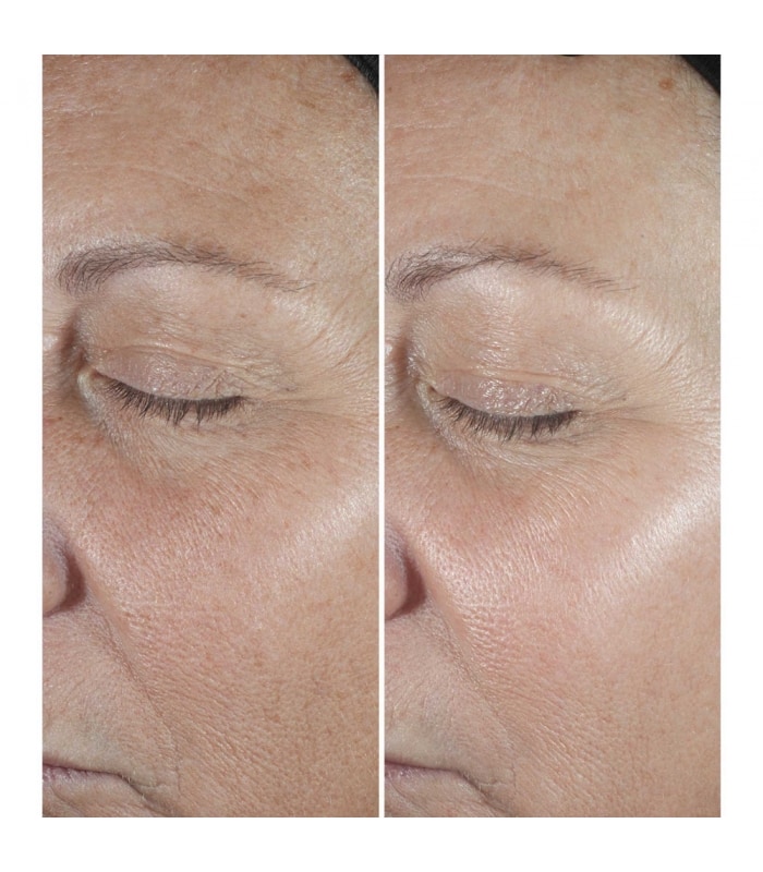 CLINIQUE SMART-Clinique Smart Clinical Repair - Sérum Correcteur Anti-rides