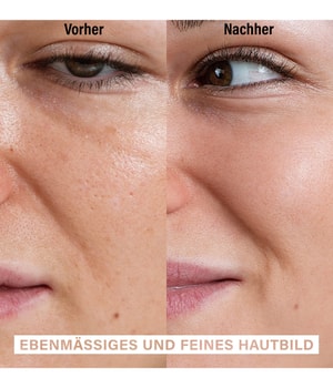 Rosental Organics Skin Exfoliating Peeling Pore Refining Treatment Gesichtspeeling-30 g