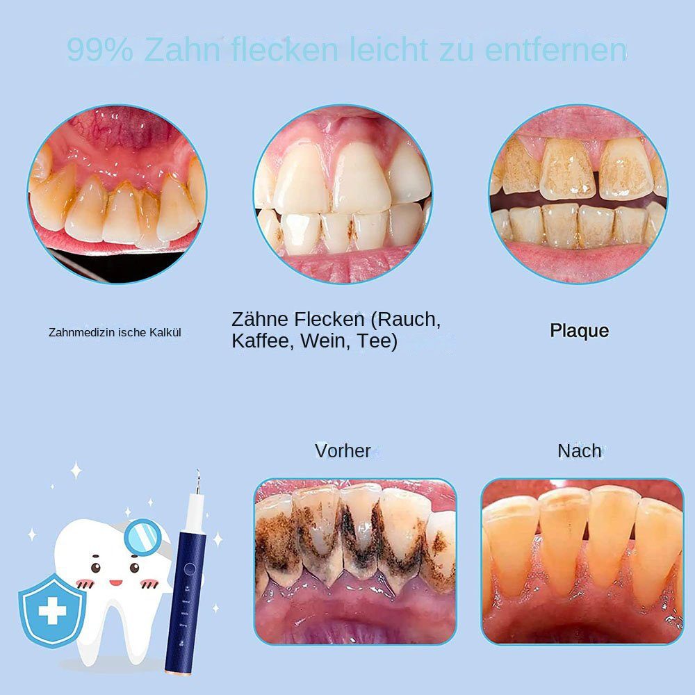 Yoyaxi Zahnpflege-Set Zahnpflege zu Hause für Menschen und Hunde, 1-tlg., Vielseitiges Zahnreinigungsset mit 4 Modi und austauschbaren Köpfen