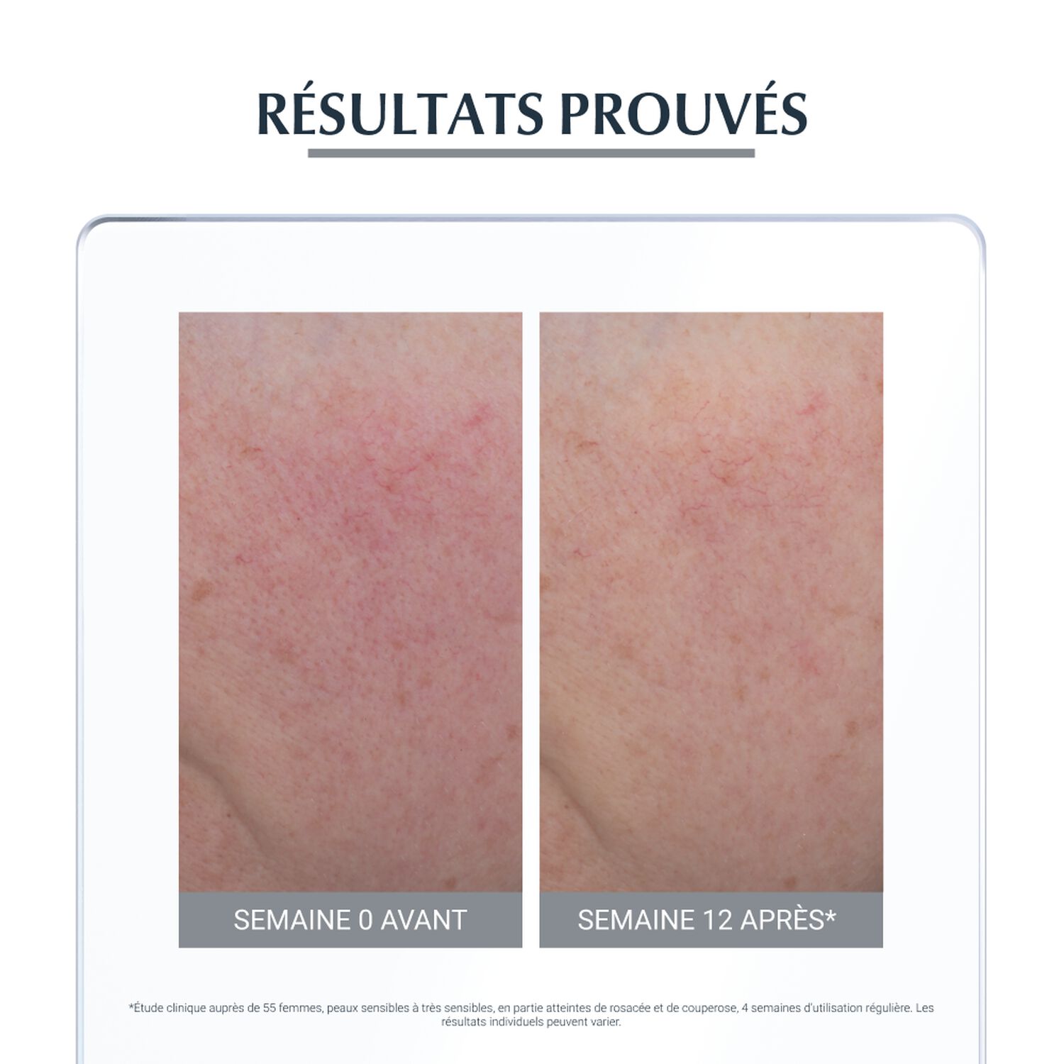 Eucerin Anti-Rougeurs Soin Jour & Nuit Apaisant - Peaux Hypersensibles