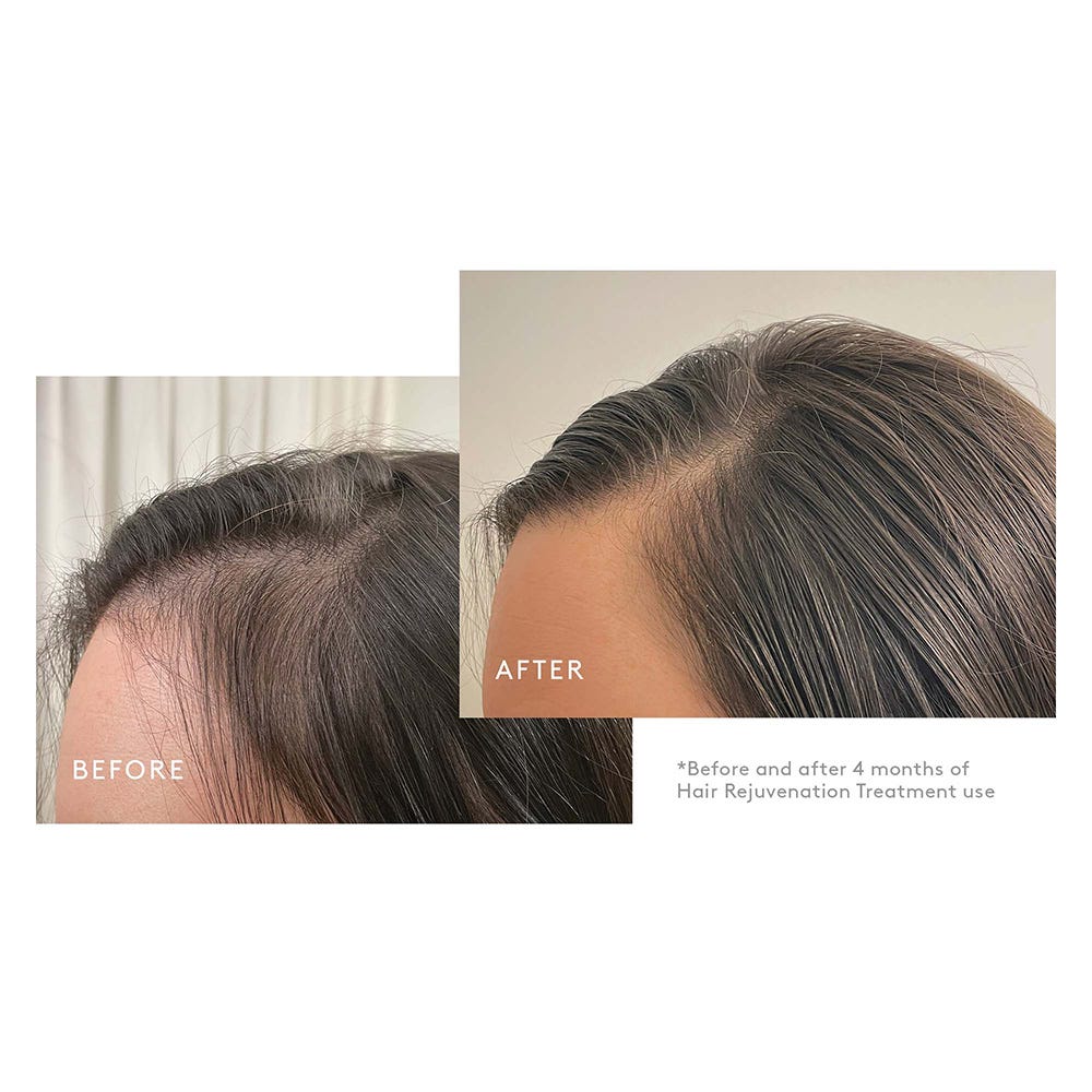 Virtue Flourish Phyto-Follicle Nutrient für 3 Monate Kit