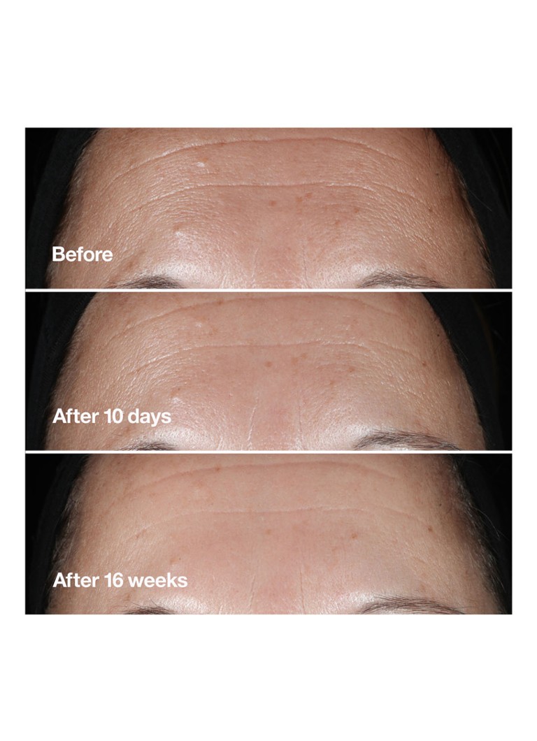 Siero antirughe Clinique Smart Clinical Repair™